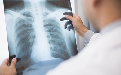 Médico analisa uma radiografia. Os sintomas do paciente, identificados na radiografia, e os resultados são relatados online por meio de videoconferência. 
Foto: Chanakon/AdobeStock