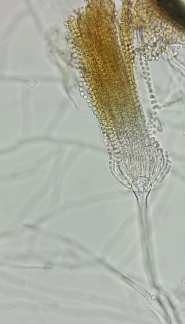 Mudanças climáticas já levam ao aumento de doenças infecciosas . Fungo do tipo Aspergilus . Foto: Sarah Tavares/ Arquivo Pessoal